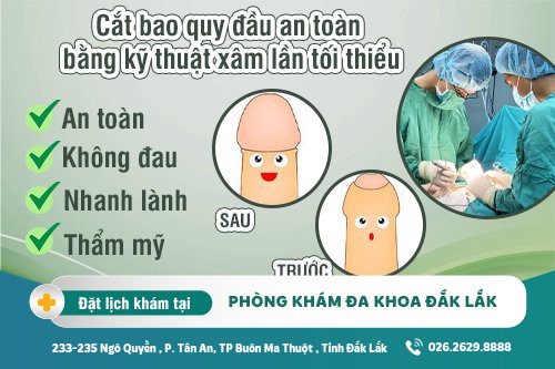 Chữa viêm bao quy đầu công nghệ cao tại Nam Khoa Đắk Lắk